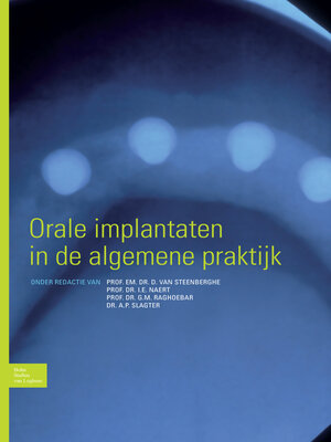 cover image of Orale implantaten in de algemene praktijk